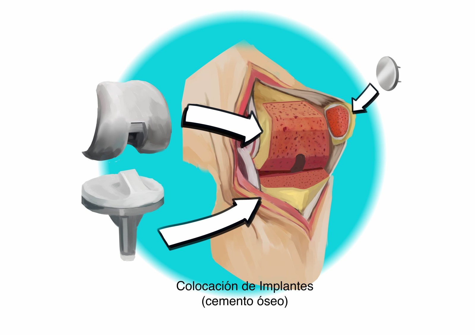 ANATOMIA Y FUNCIÓN DE LA RODILLA – Rafael Pérez Nuñez